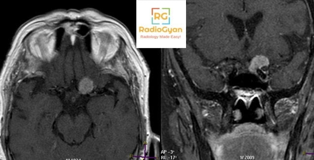 Spotters 1 Radiology Spotters