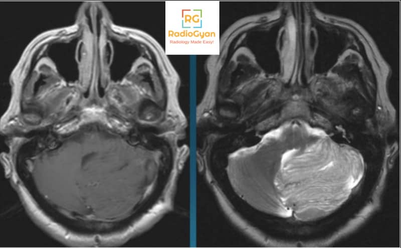 Spotters Set 2 radiology spotters