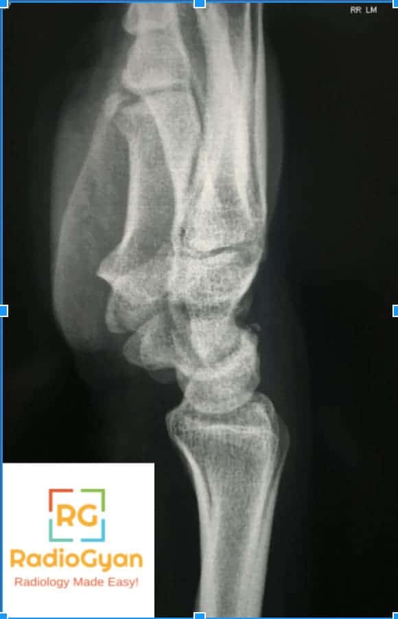 Spotter set 5 Radiology Spotters