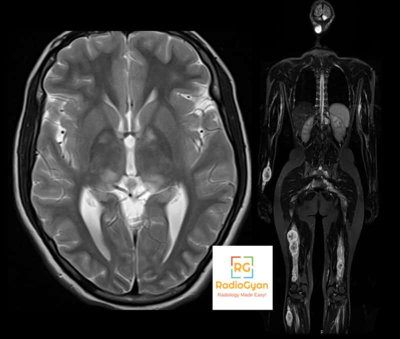 Spotters set 6 MSK radiology spotters