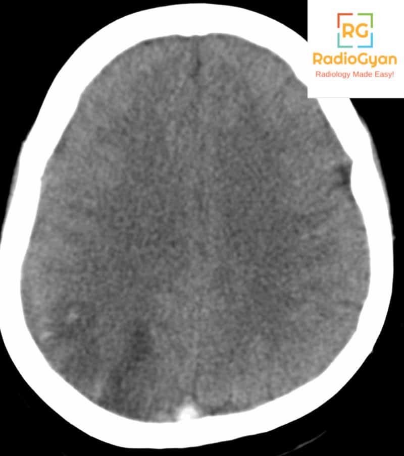 Spotters set 7 Radiology Spotters