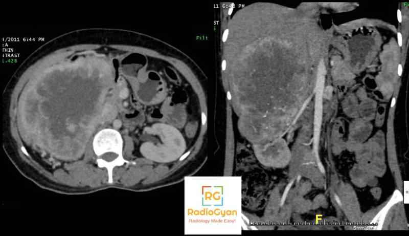 Radiology Spotters 9