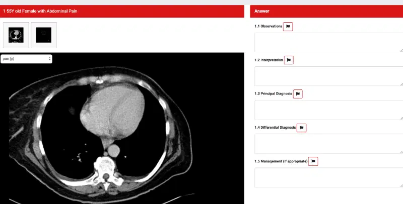 FRCR long case example