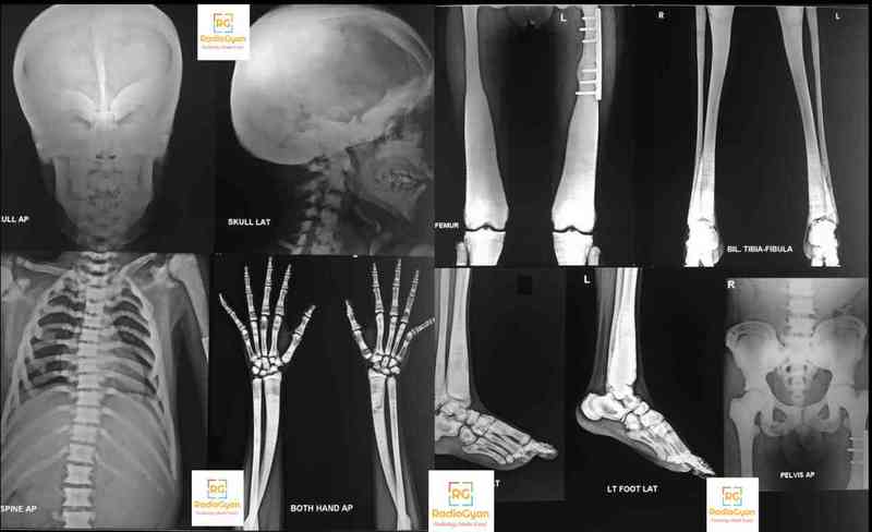 Radiology Spotters 11