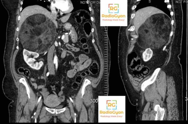 Radiology Spotters Set 18 | Body Imaging Radiology spotters