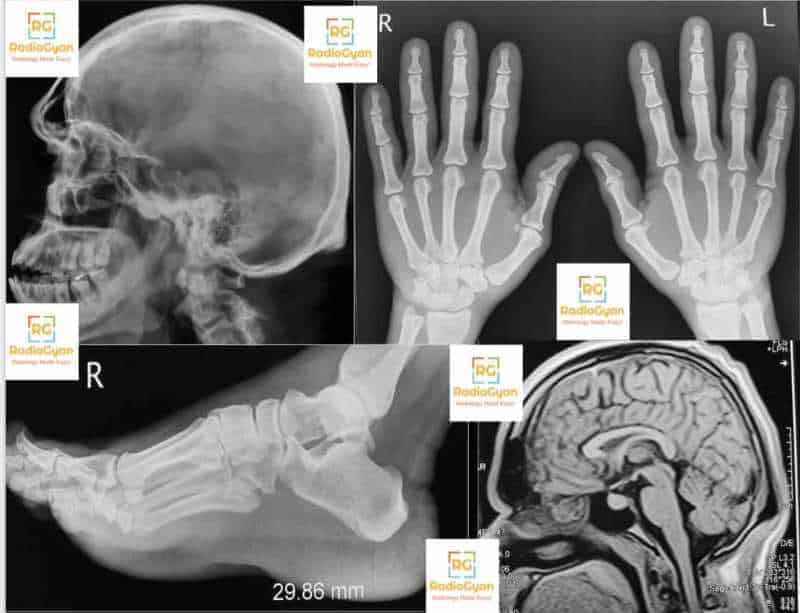 Neuroradiology Spotters RadioGyan.com