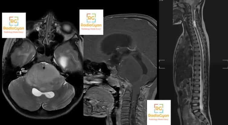 Radiology Spotters set 25 RadioGyan.com