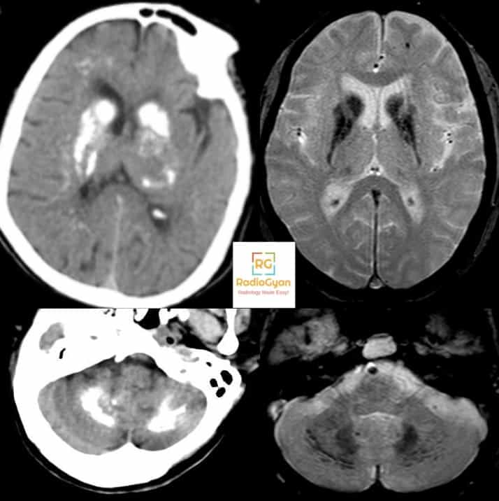 Learning Radiology spotters | Radiogyan