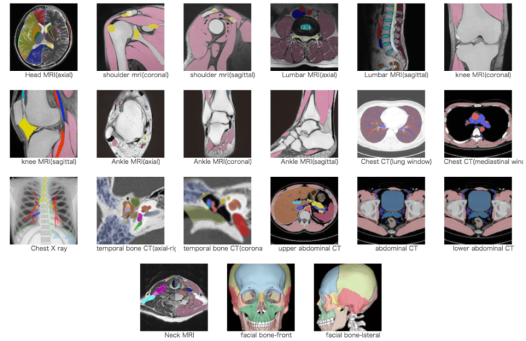 Radiological Anatomy- MOST Definitive Collection of Anatomy Modules!