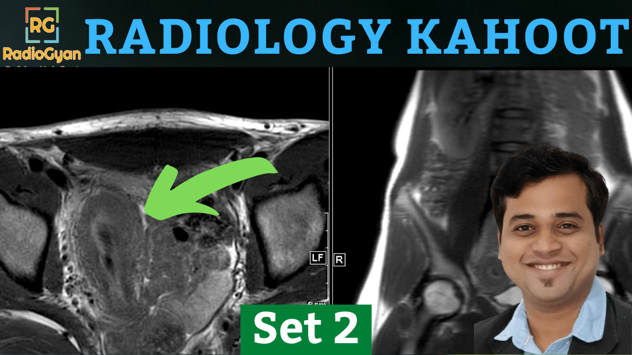 Radiology Kahoot Quiz 2nd Edition