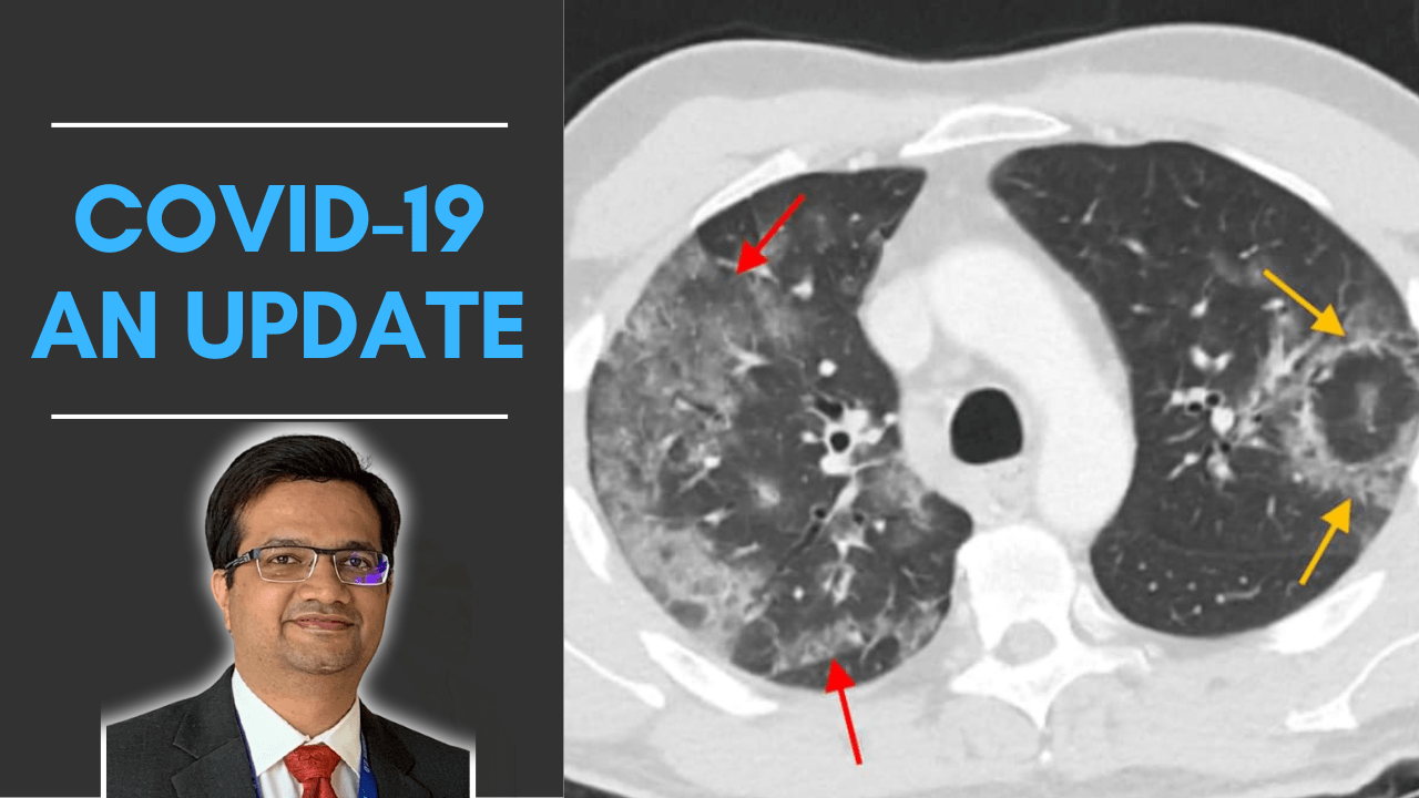 COVID-19 Radiology Update
