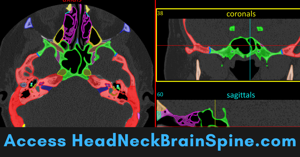 How to View HeadnNeckBrainSpine.com Anatomy Modules