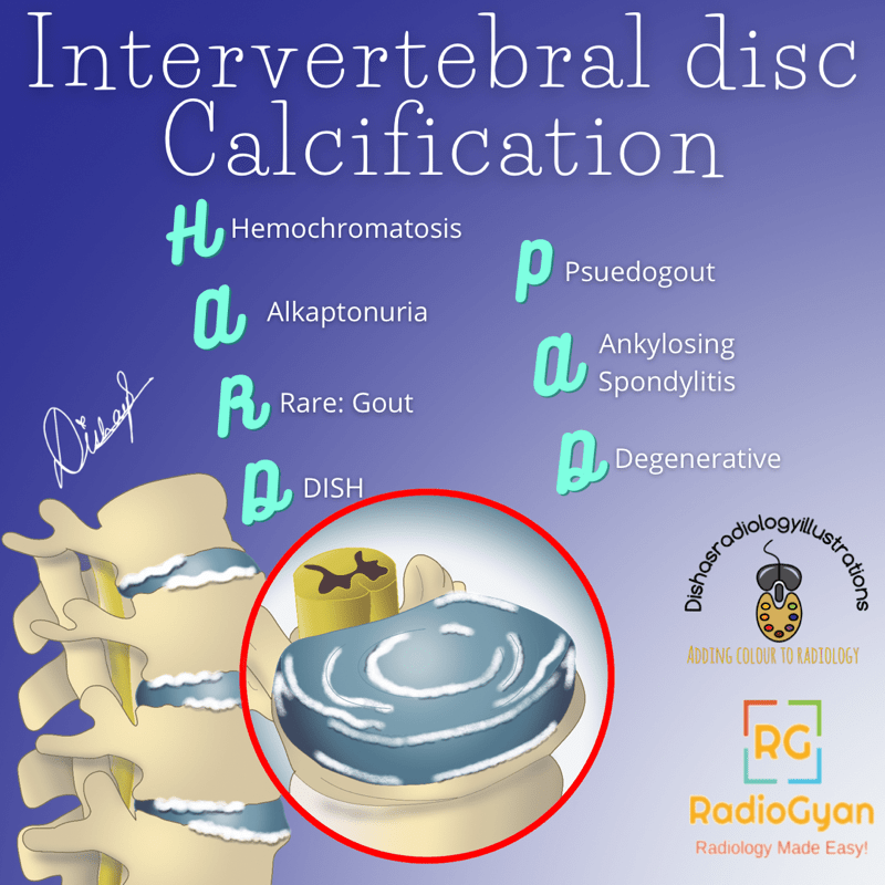 Intervertebral Disc Calcification