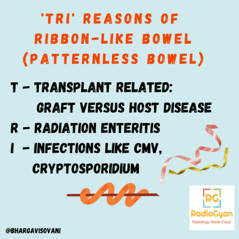 Paternless Causes Of Patternless Bowel - Visual Mnemonics