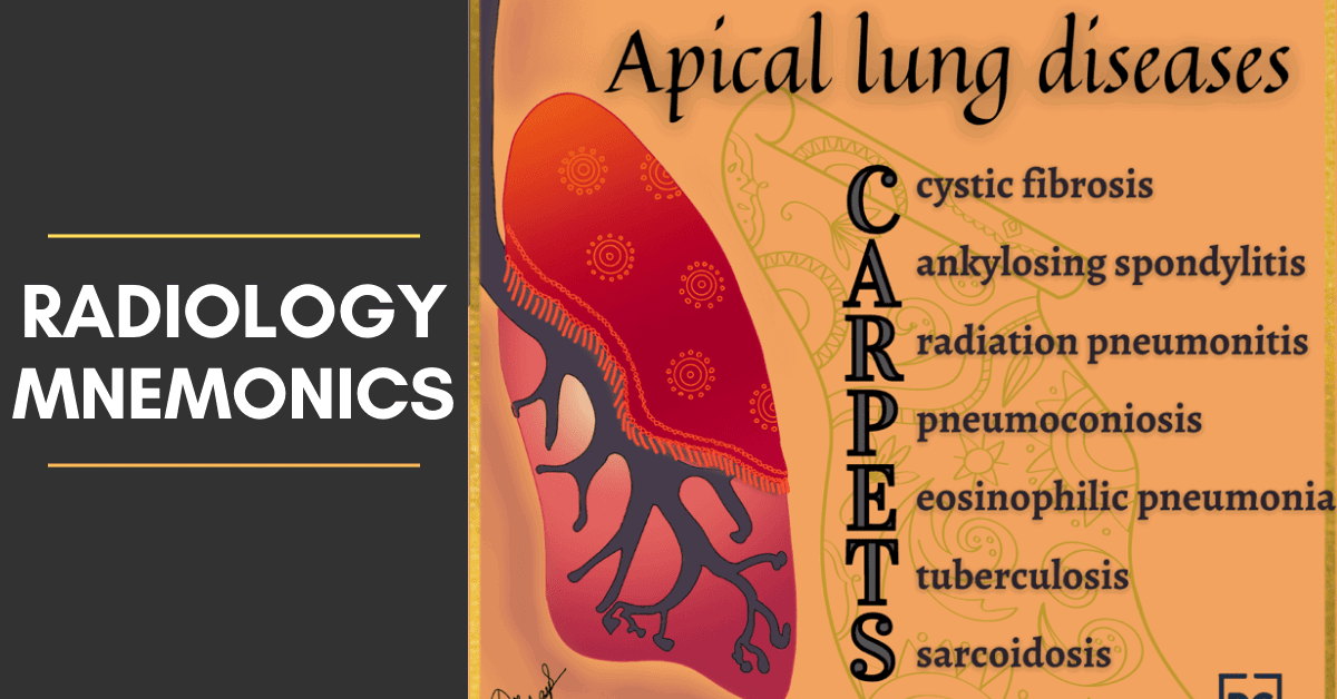 Radiology Mnemonics, Illustrated diagram showing mnemonic aid: CARPETS, for Apical Lung Diseases. Listing Cystic fibrosis, Ankylosing spondylitis, Radiation pneumonitis, Pneumoconiosis, Eosinophilic pneumonia, Tuberculosis, Sarcoidosis, on an orange background, adjacent to a stylized, color-shaded, human lung illustration.