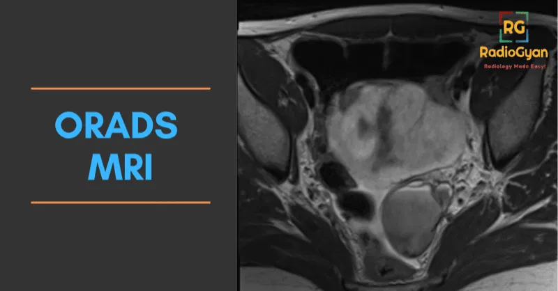 ORADS MRI