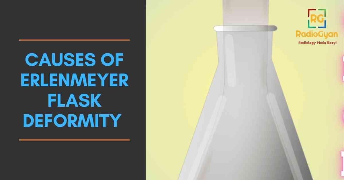 causes of Erlenmeyer Flask Deformity