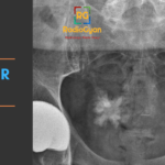 Body Imaging Radiology Cases - Spotter Set 71