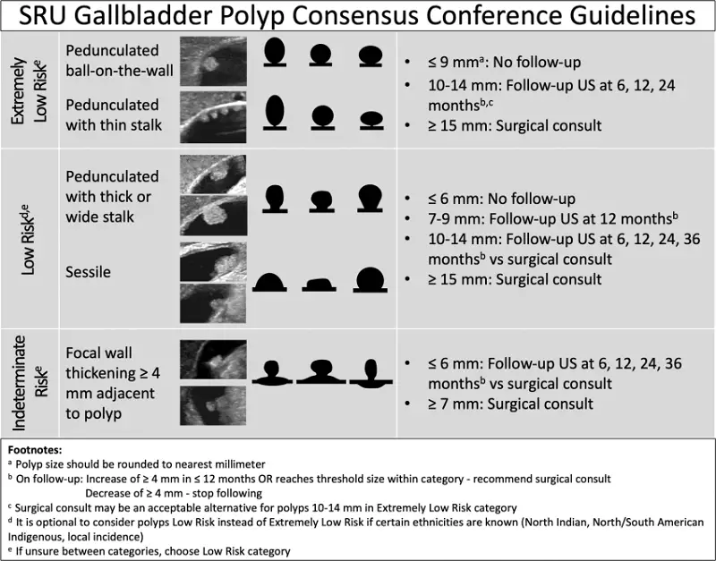Gallbladder Polyp Recommendation Tool [SRU Guidelines] - RadioGyan
