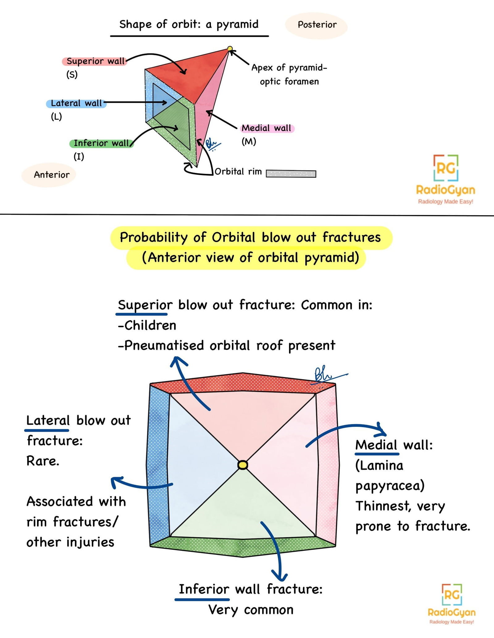Pathophysiology of common orbital fractures.