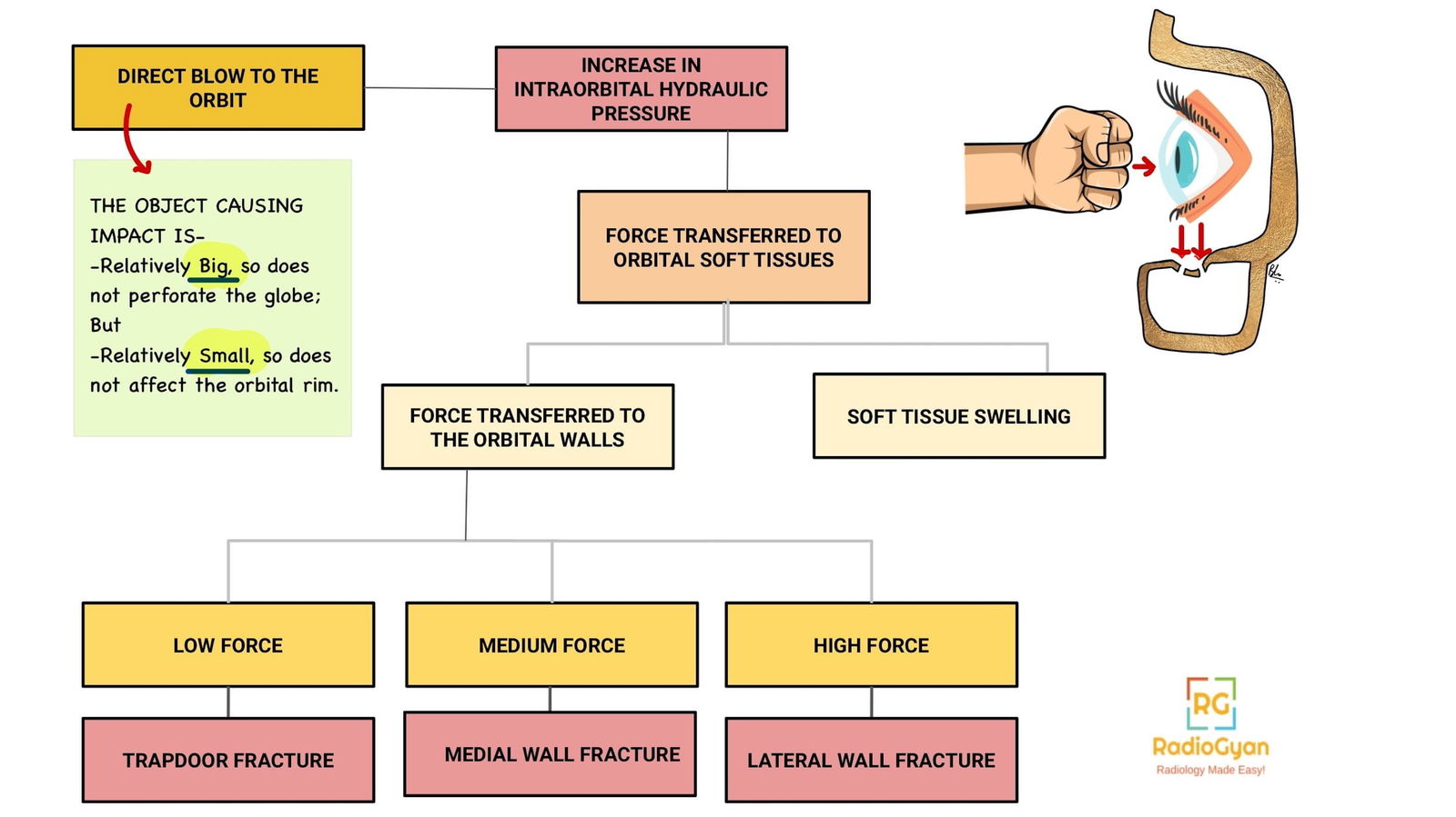 Pathophysiology of orbital fractures .
