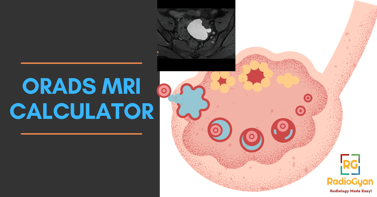 O-RADS MRI Calculator for Ovarian Cysts v2024