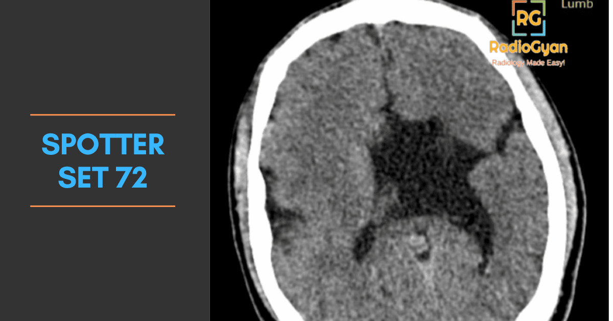 Radiology Spotter Cases Set 72