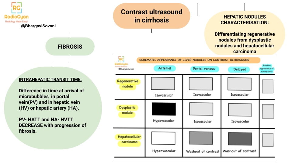 Schematic representations with simple line diagrams illustrating contrast ultrasound findings in cirrhotic livers. The diagrams highlight typical imaging features and patterns associated with cirrhosis, aiding in the differentiation from normal liver tissue.