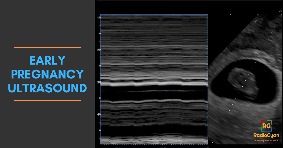 Early Pregnancy Ultrasound - Video tutorial