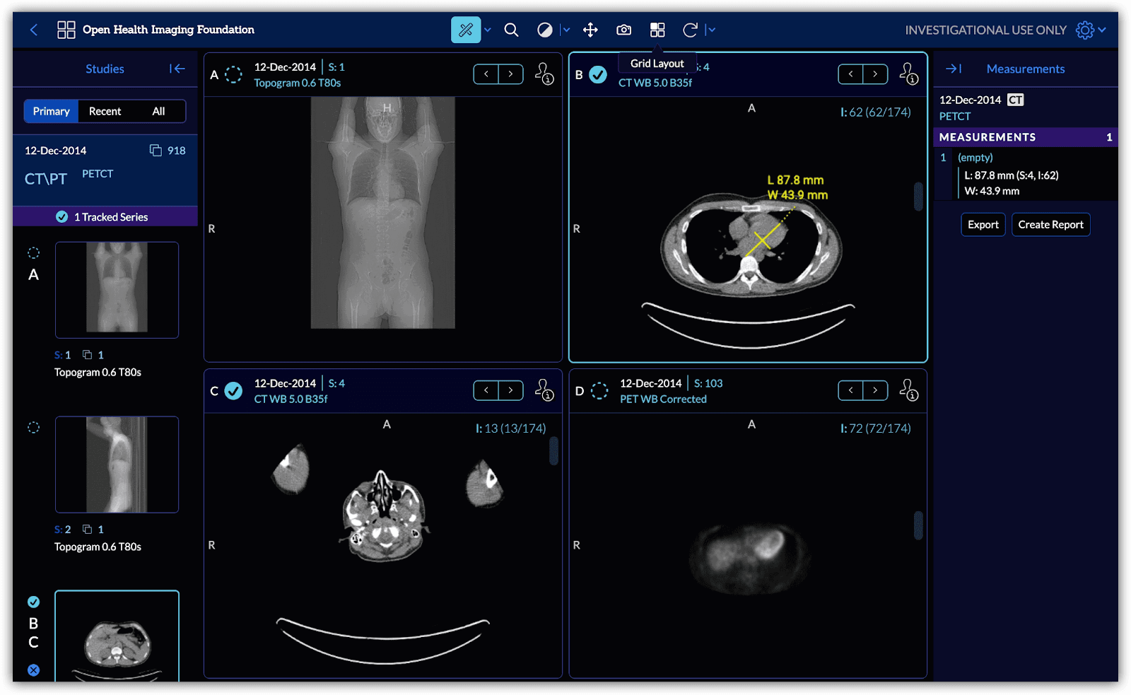 OHIF DICOM Viewer Example image