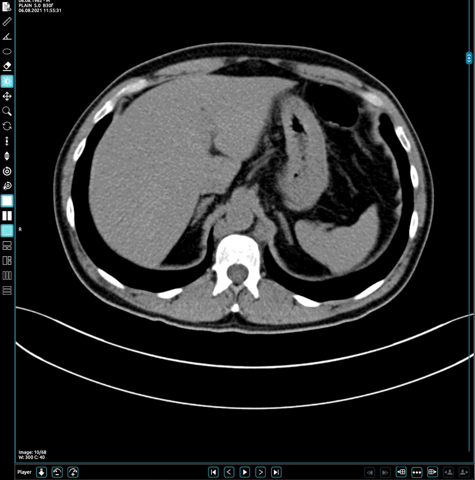 PostDICOM viewer Example Image