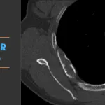 Spotter Set 76 10 Radiology Board Exam cases