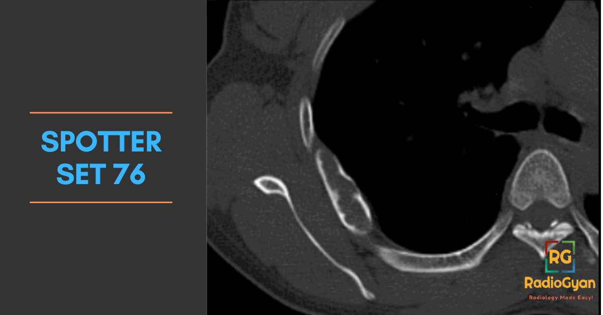 Spotter Set 76 10 Radiology Board Exam cases