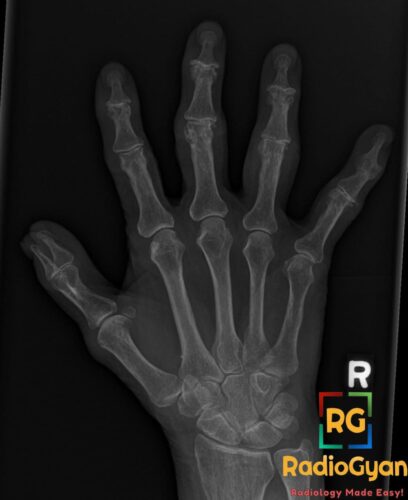 Radiology Signs