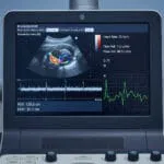 Doppler ultrasound screen displaying RI calculator, fetal imaging, and waveforms for resistivity index measurement.