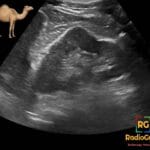 Ultrasound image of a left kidney showing a dromedary hump, a normal kidney variant, with a camel icon for illustration.