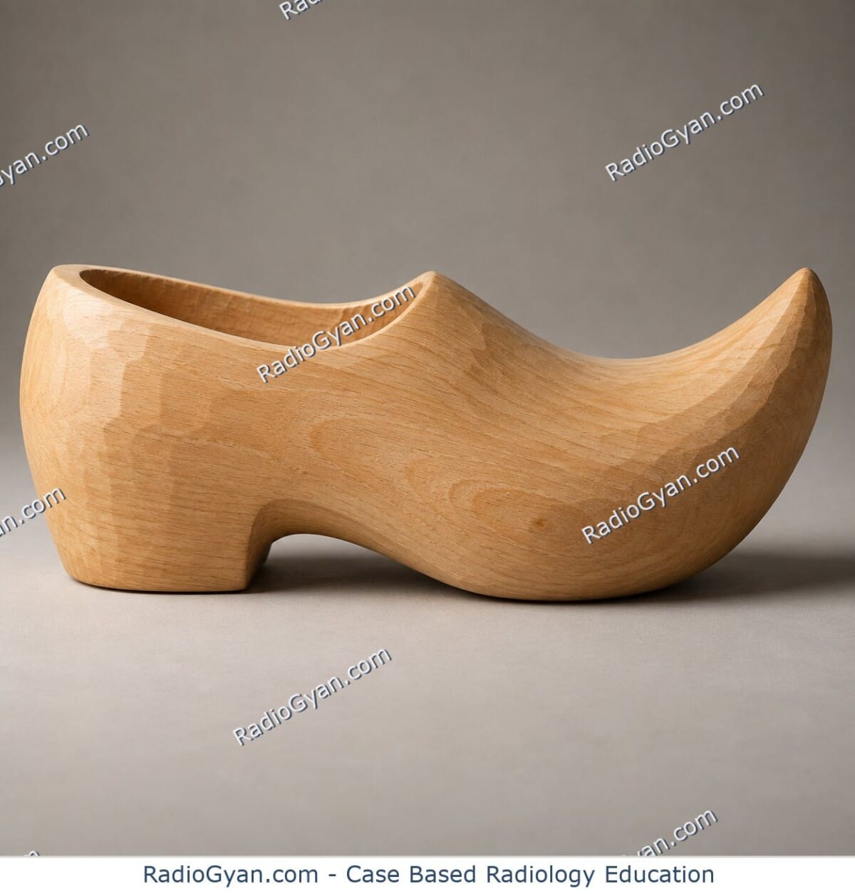Traditional carved wooden sabot clog in side profile, illustrating the boot-shaped heart sign of Tetralogy of Fallot.