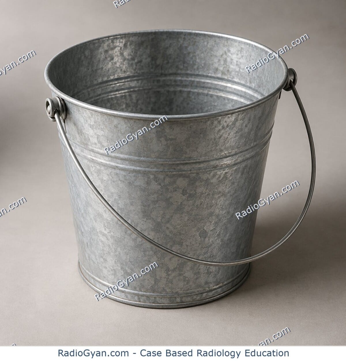 A vintage metal bucket resting upright with its wire bail handle hinged down against its rim, illustrating the bucket handle tear metaphor.