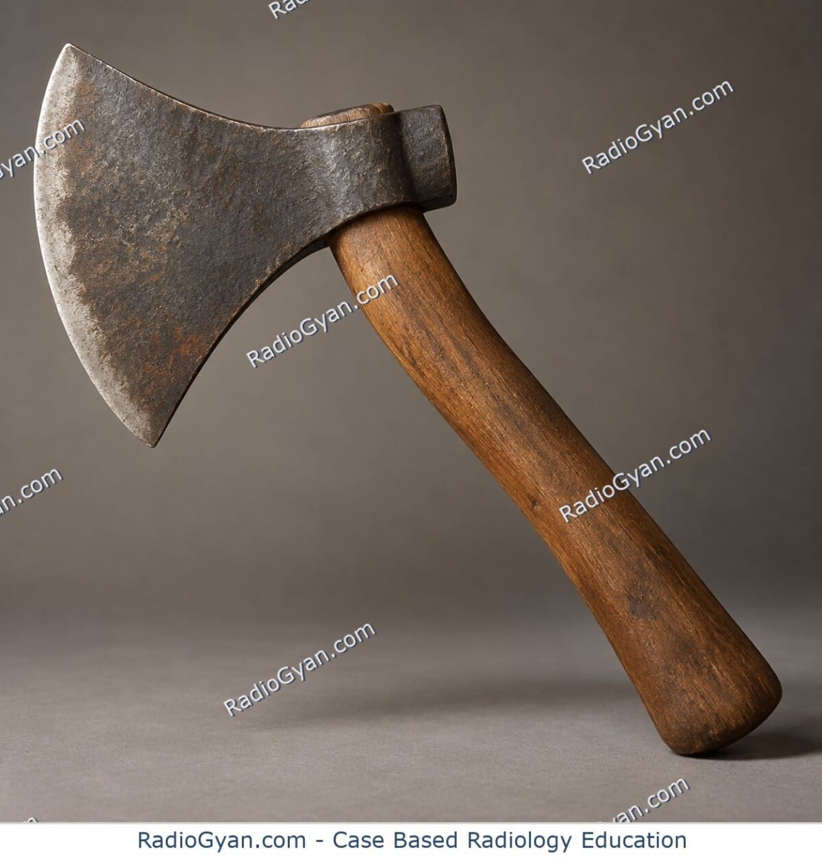 Ancient hand hatchet with a broad wedge-shaped blade, illustrating the Hatchet sign.