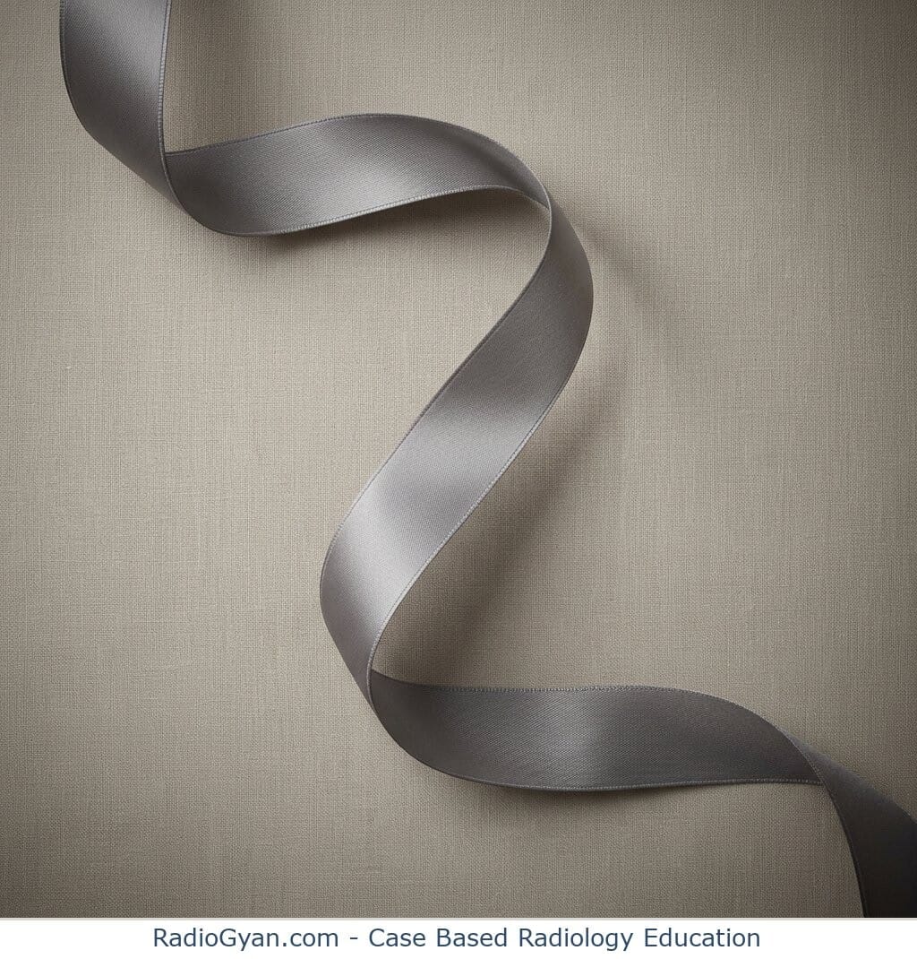 A thin grey satin ribbon curving in a smooth S-curve, the object the insular ribbon sign is named after.