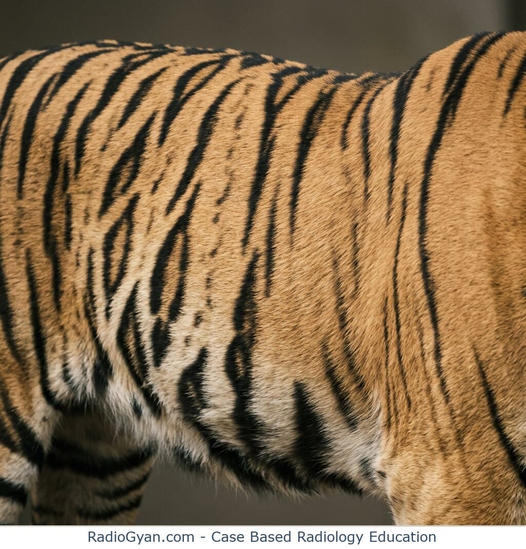 Close-up of a tiger's flank with bold black stripes running across orange-gold fur, illustrating the tigroid stripe sign.