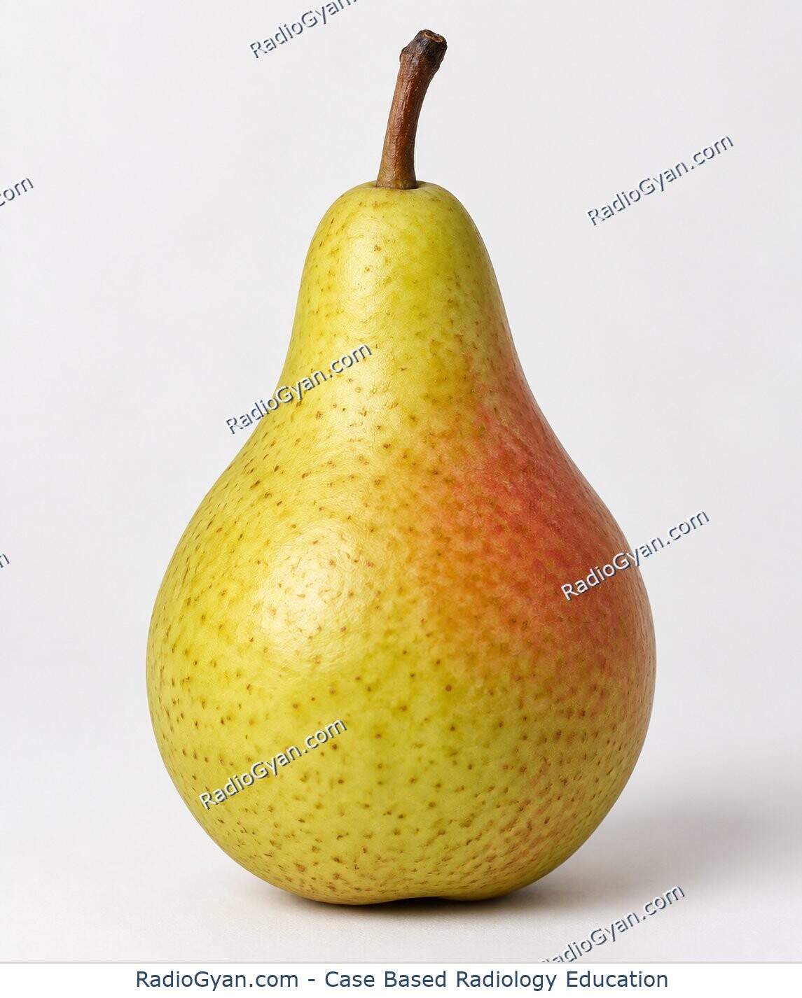 A pear illustrating the pear-shaped bladder radiology sign.