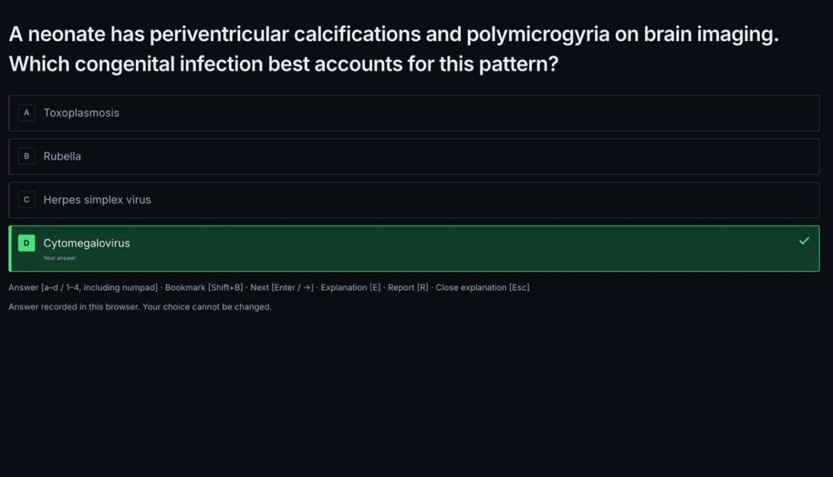 RadioGyan MCQ app question screen with answer options and keyboard shortcuts